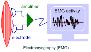 elettromiografia